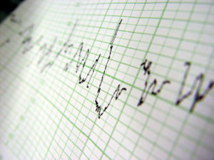 CERNUSCO - Cardiologie aperte